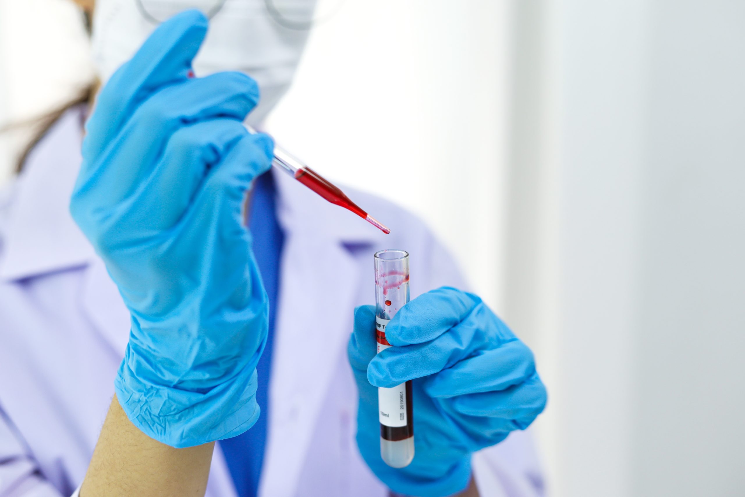 Scientist holding Coronavirus covid-19 infected blood sample tube DNA testing of the blood in the laboratory with blood sample collection tubes and syringe Coronavirus Covid-19 vaccine research.